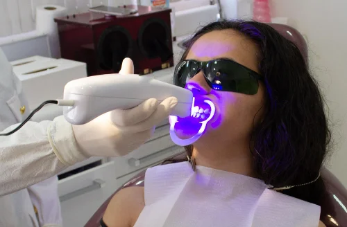 Teeth Whitening dentist in North York