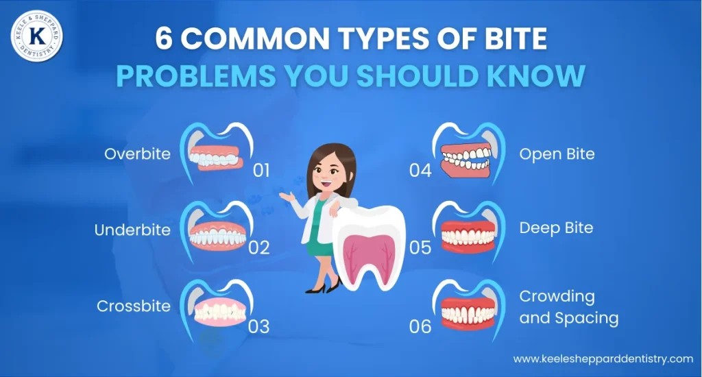 Common Types of Bite Problems You Should Know