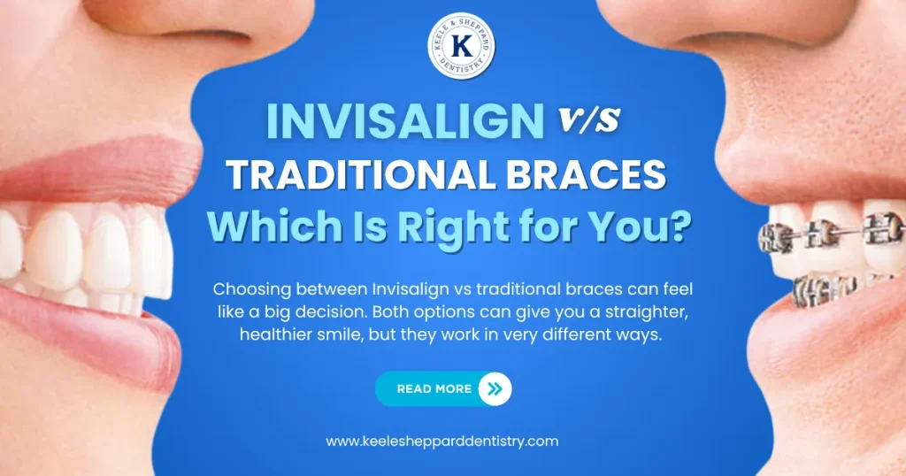 Invisalign vs traditional braces