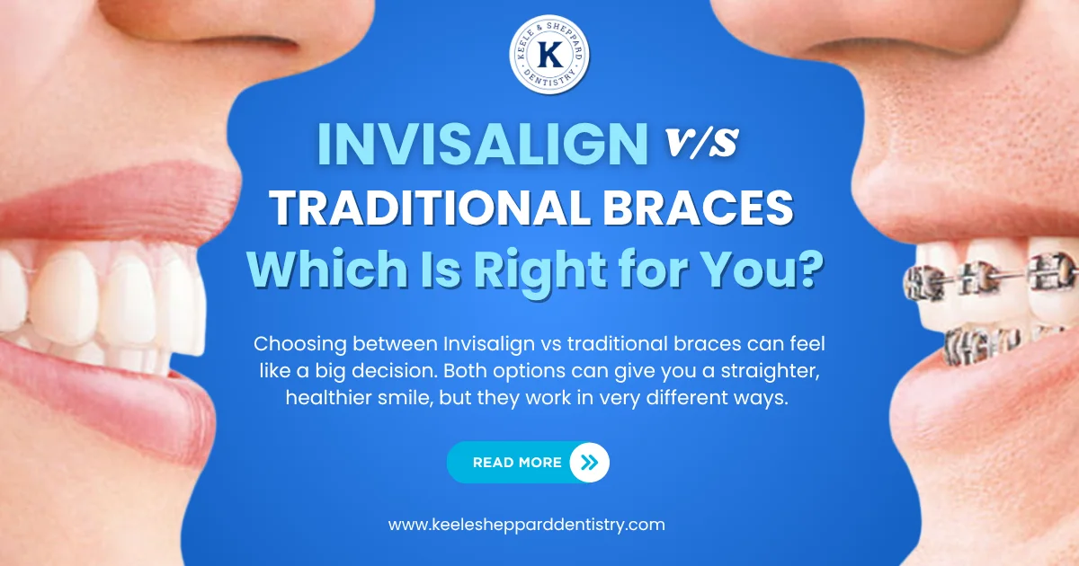 Invisalign vs traditional braces