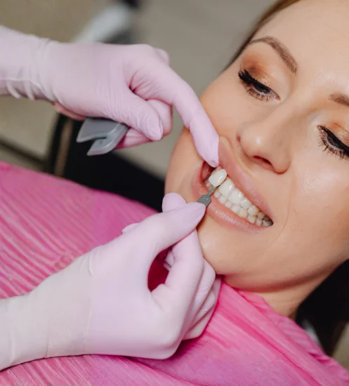 Porcelain Veneers treatment