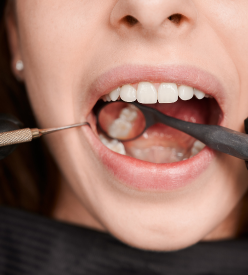 What Is TMJ Disorder