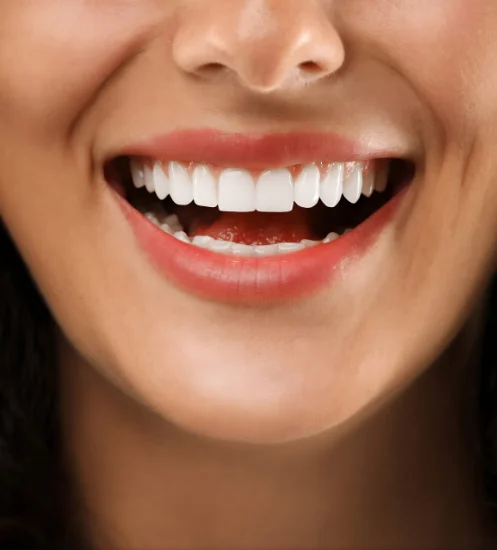 Why Regular Dental Cleanings Matter