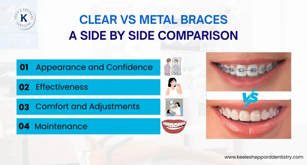 Clear vs Metal Braces