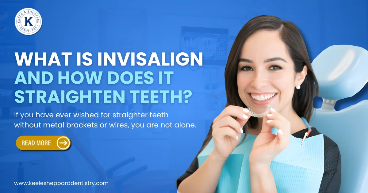 Invisalign clear aligners