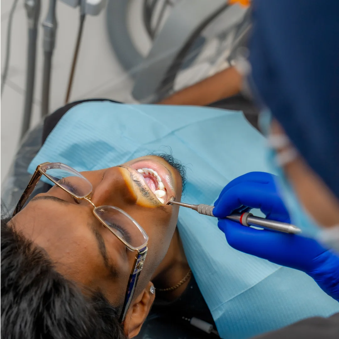 Why Choose Professional Teeth Whitening in North York